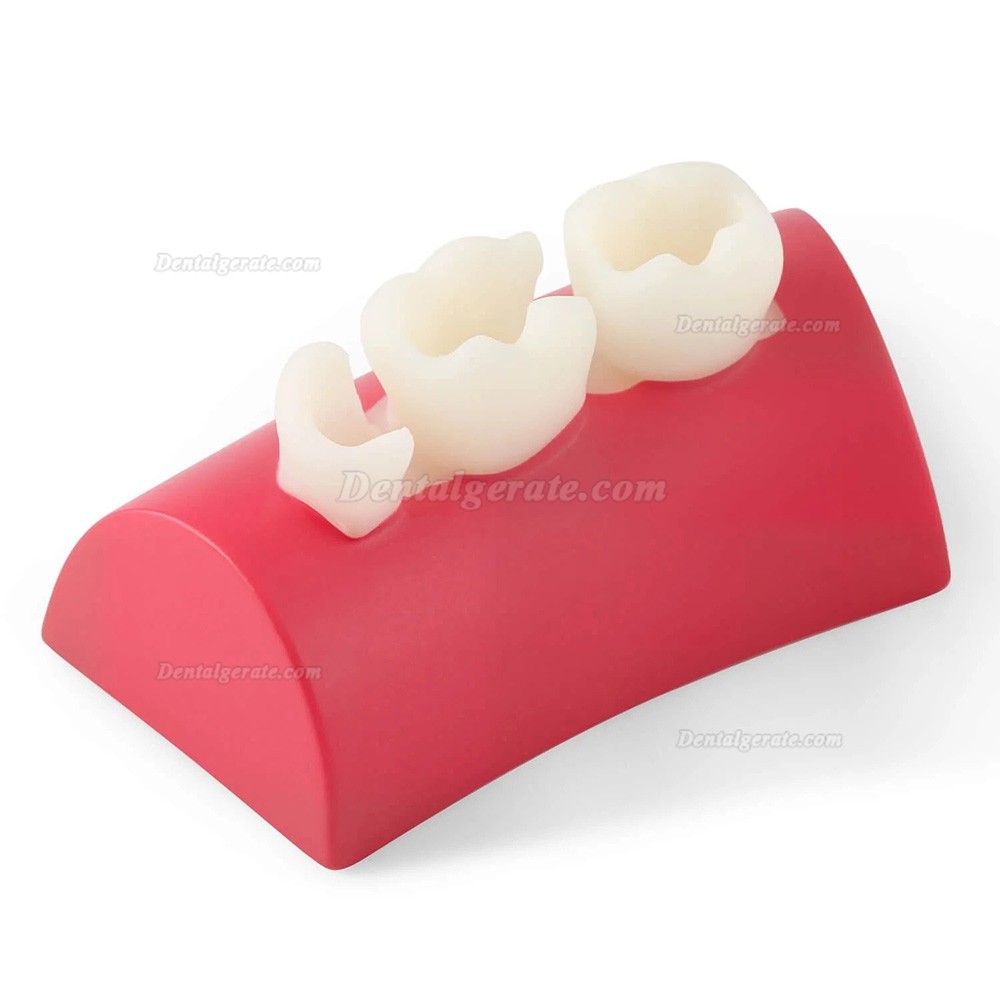 Dental Inlay &Uuml;bungsblock Komposit-Harz F&uuml;llung Z&auml;hne